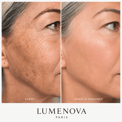 Femme soin visage masque led IA luminothérapie anti-rides résultats Lumenova Paris